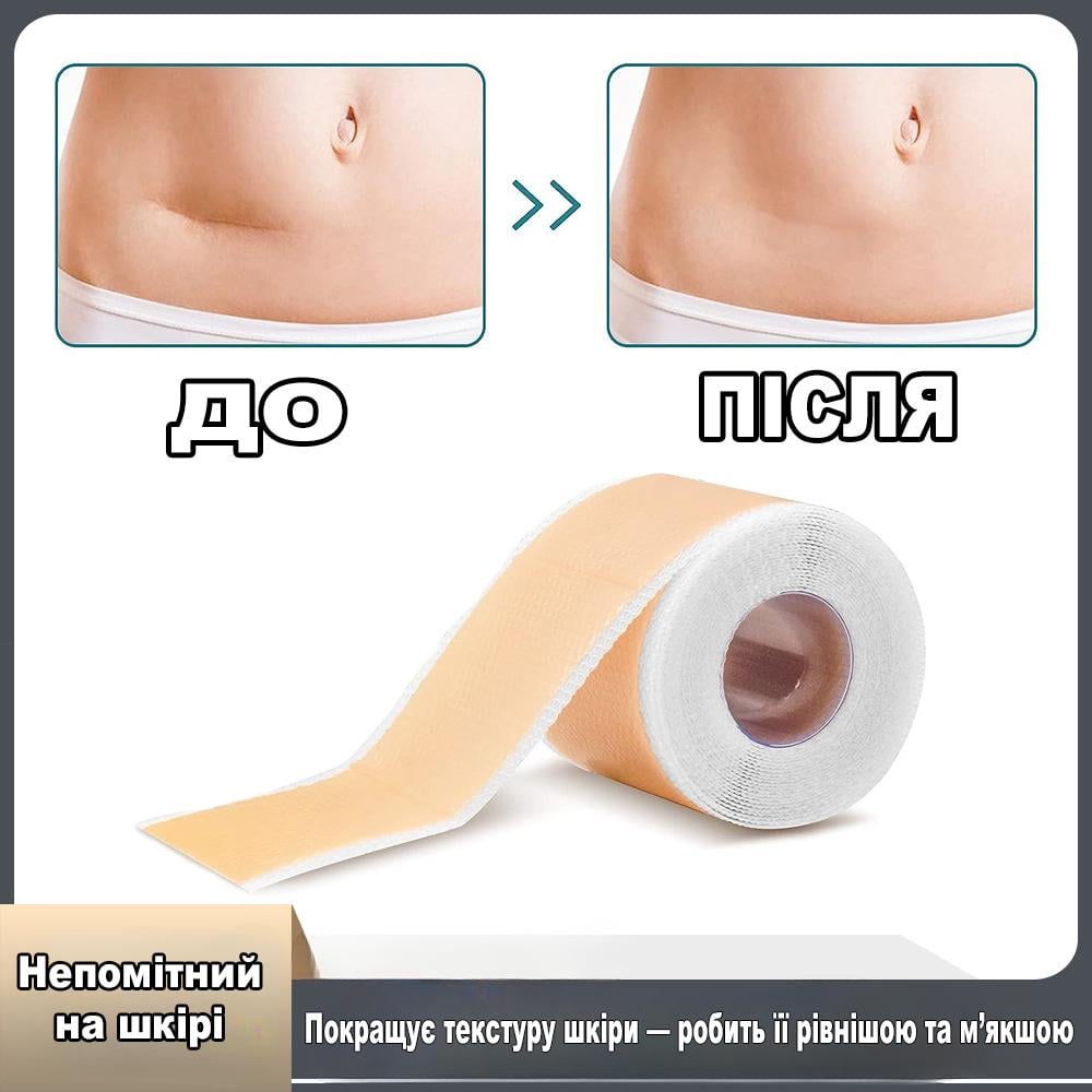 Силіконовий пластир від післяопераційних рубців/для шрамів після кесаревого/швів/опіків 4х150 см (R9379) - фото 10 Силіконовий пластир від післяопераційних рубців/для шрамів після кесаревого/швів/опіків 4х150 см (R9379) - фото 10