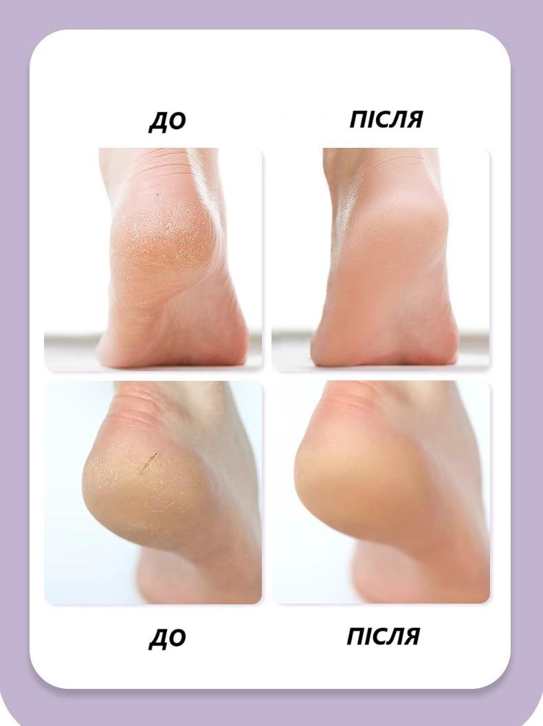 Носки для сухой и потрескавшейся кожи ног увлажняющие гелевые Розовый (29256 рож) - фото 5