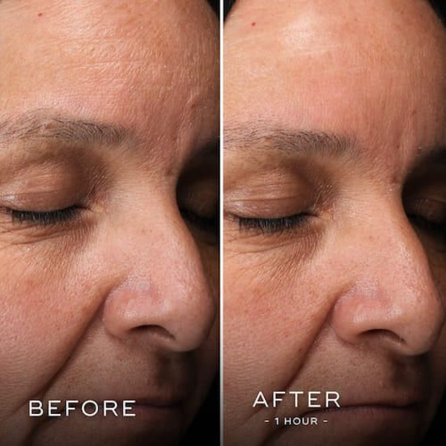 Маска для оптимального увлажнения для лица и шеи Medik8 H.E.O. ночная 2-этапная 2x50 мл (BQ-060) - фото 4 Маска для оптимального увлажнения для лица и шеи Medik8 H.E.O. ночная 2-этапная 2x50 мл (BQ-060) - фото 4