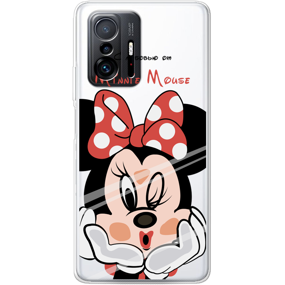 Чохол BoxFace Xiaomi 11T / 11T Pro Lady M Прозорий силікон (43423-cc59-43423)