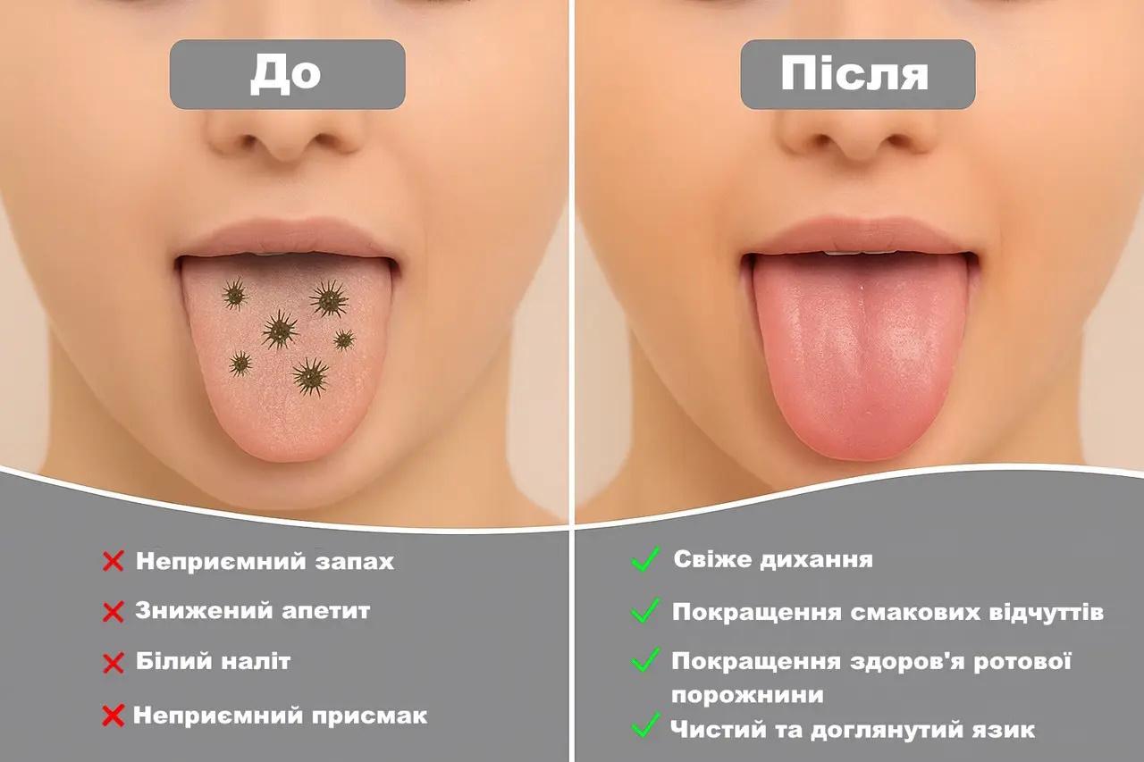 Набор скребков для языка Moolo 4в1 из нержавеющей стали в чехле - фото 2 Набор скребков для языка Moolo 4в1 из нержавеющей стали в чехле - фото 2