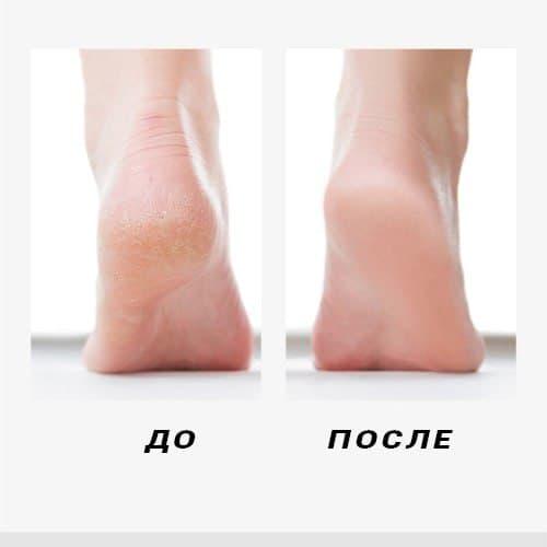 Пилка аккумуляторная Calluses Remover 2 насадки - фото 2