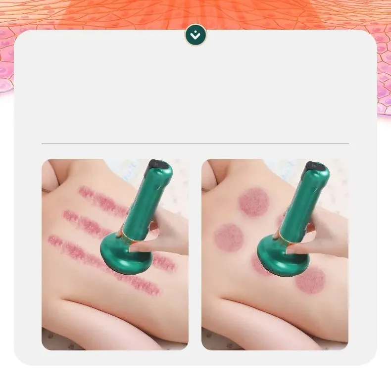 Масажер для тіла Cupping Massager III вакуумний Зелений - фото 4