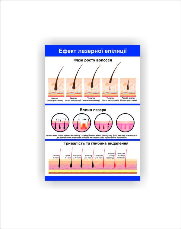 Плакат Vivay Эфект лазерной эпиляции 60х80 см (25634024)