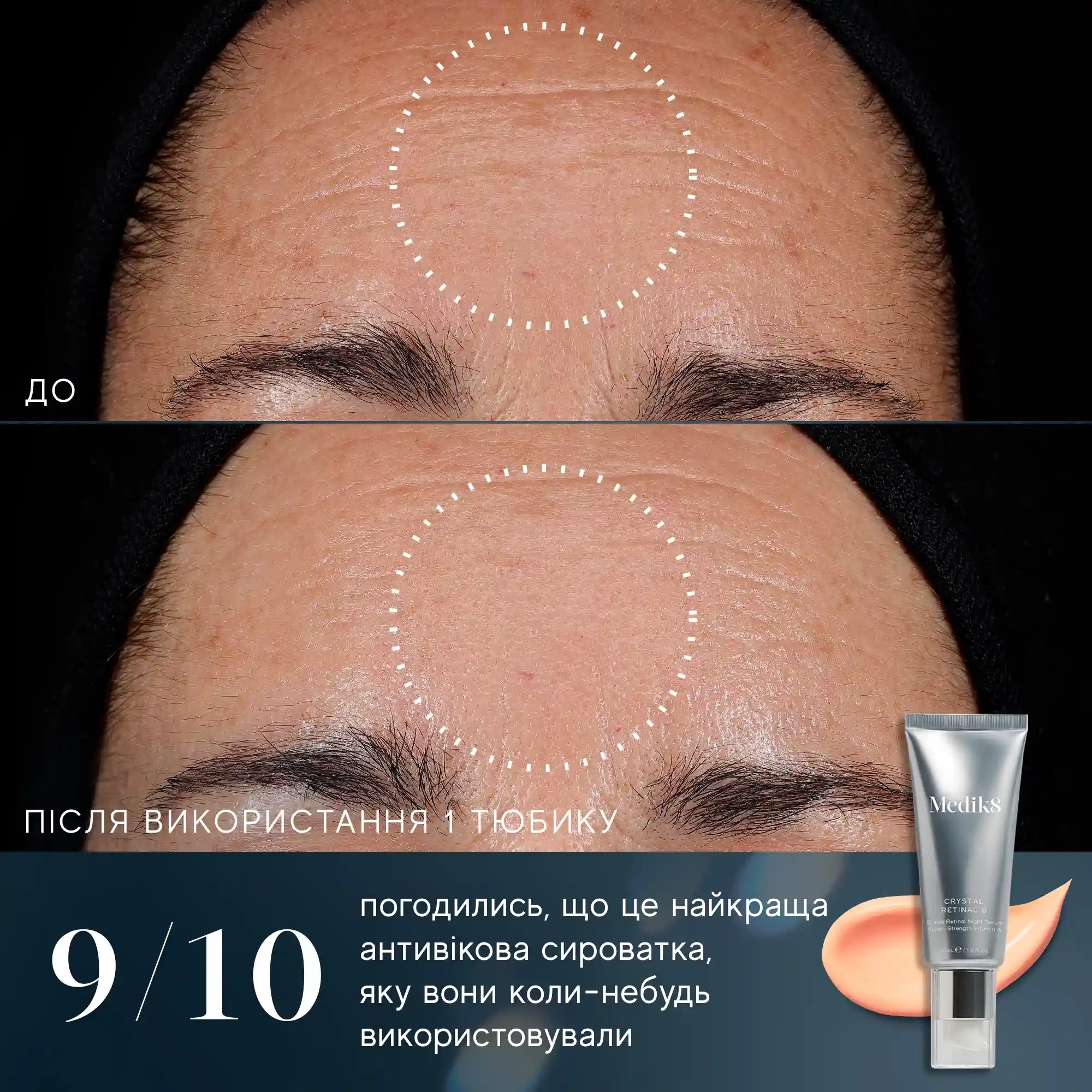 Крем-сыворотка ночная MEDIK8 CRYSTAL RETINAL 3 с ретинолом 0,03% (BQ-039) - фото 4 Крем-сыворотка ночная MEDIK8 CRYSTAL RETINAL 3 с ретинолом 0,03% (BQ-039) - фото 4