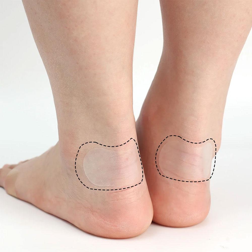 Рулон нестандартных пластырей для стопы Белый (NR0290_1) - фото 5 Рулон нестандартных пластырей для стопы Белый (NR0290_1) - фото 5