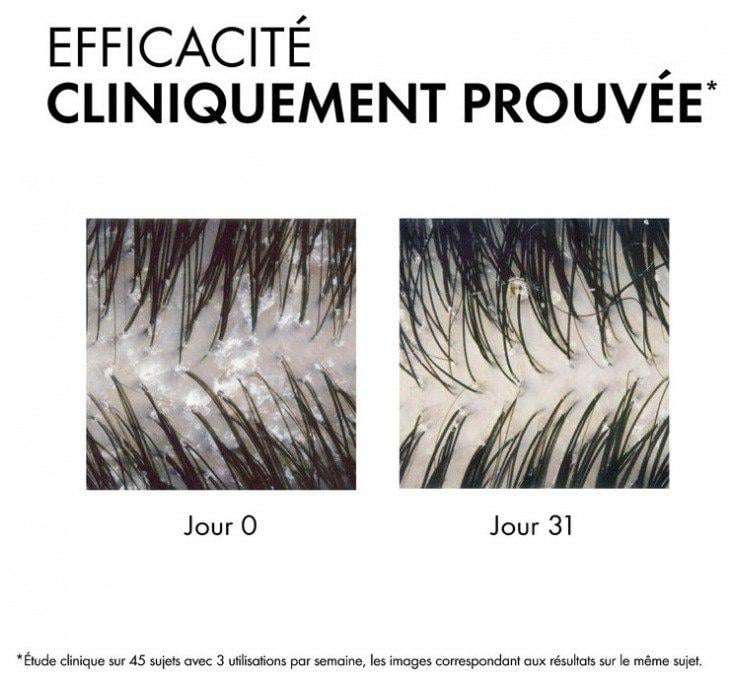 Шампунь против перхоти Vichy Dercos для жирных волос и раздраженной кожи головы 390 мл (24945881) - фото 5