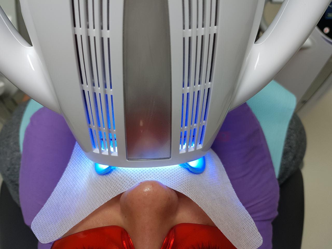 Салфетки для коффердама POLIX PRO&MED из спанбонда 50 шт. Белый (2538725570) - фото 4 Салфетки для коффердама POLIX PRO&MED из спанбонда 50 шт. Белый (2538725570) - фото 4