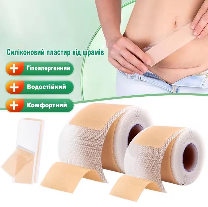 Пластырь для заживления рубцов после операции медицинский силиконовый при ожогах/растяжка/акне - фото 6