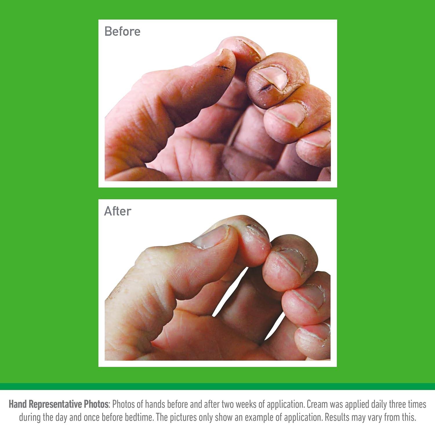 Крем для сухой и потрескавшейся кожи рук заживляющий O'Keeffe's Working Hands 96 г (2733687734) - фото 2 Крем для сухой и потрескавшейся кожи рук заживляющий O'Keeffe's Working Hands 96 г (2733687734) - фото 2