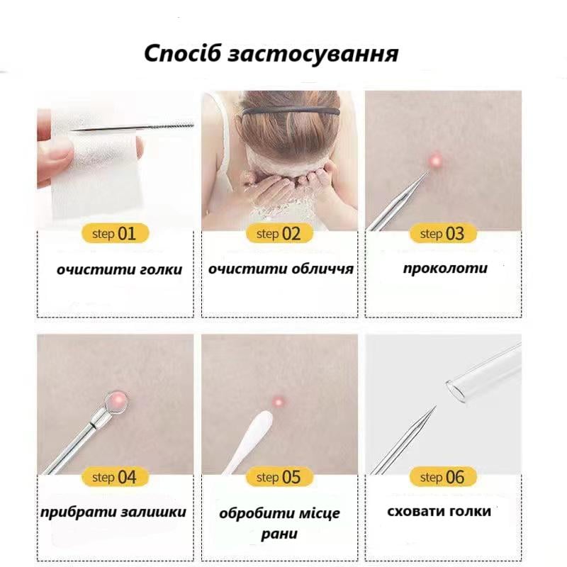 Инструменты для чистки лица из 4 игл от черных точек и угрей (U9264) - фото 2