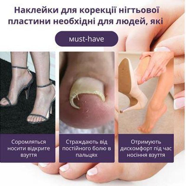 Набор пластырей Elastic Toenail Correction Sticker 50 pcs (ECS1000) - фото 3