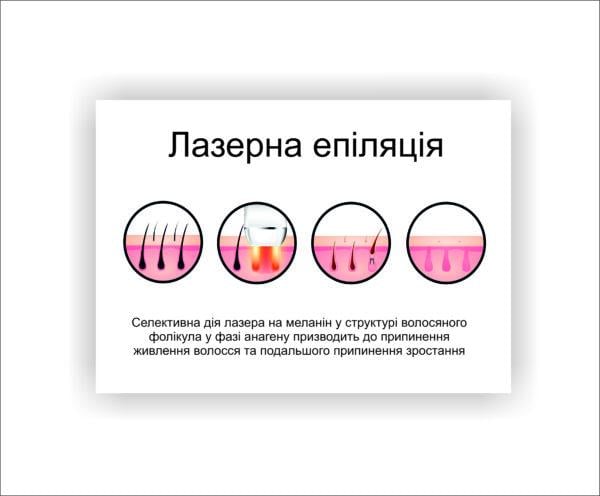 Плакат Vivay Лазерная эпиляция 60х80 см (23272616)