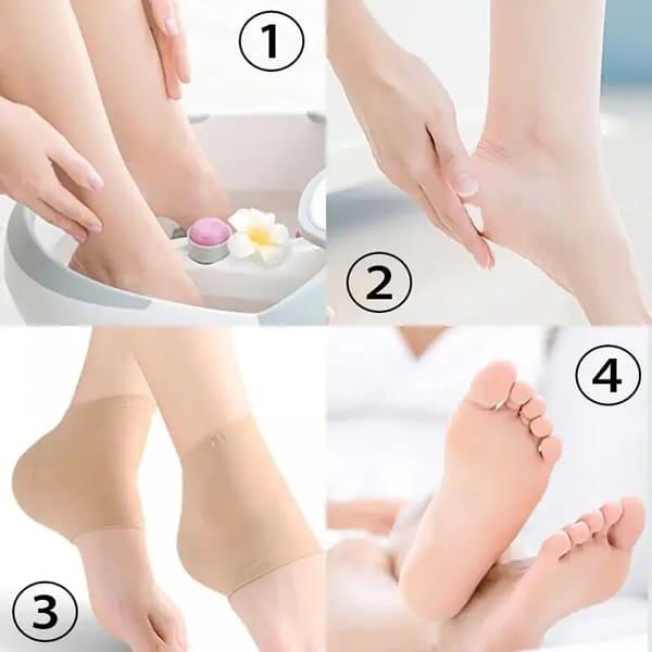 Шкарпетки-підп'ятники Масажні з акупунктурним покриттям Бежевий (id_4005) - фото 3 Шкарпетки-підп'ятники Масажні з акупунктурним покриттям Бежевий (id_4005) - фото 3