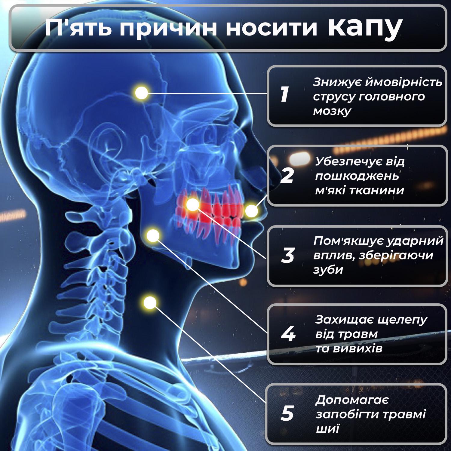 Капа Вампир подростковая для зубов из термопластика Черный - фото 4