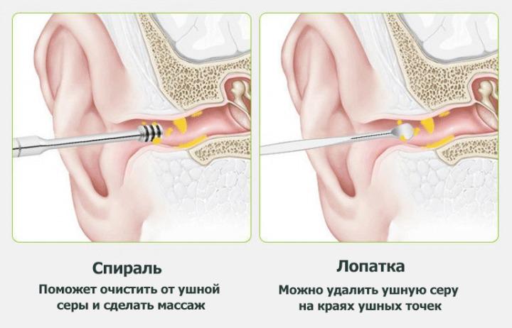 Набор инструментов для чистки ушей Good Idea Tool Set 6 пр. в футляре 11,7х10х3 см Черный (21154M) - фото 7