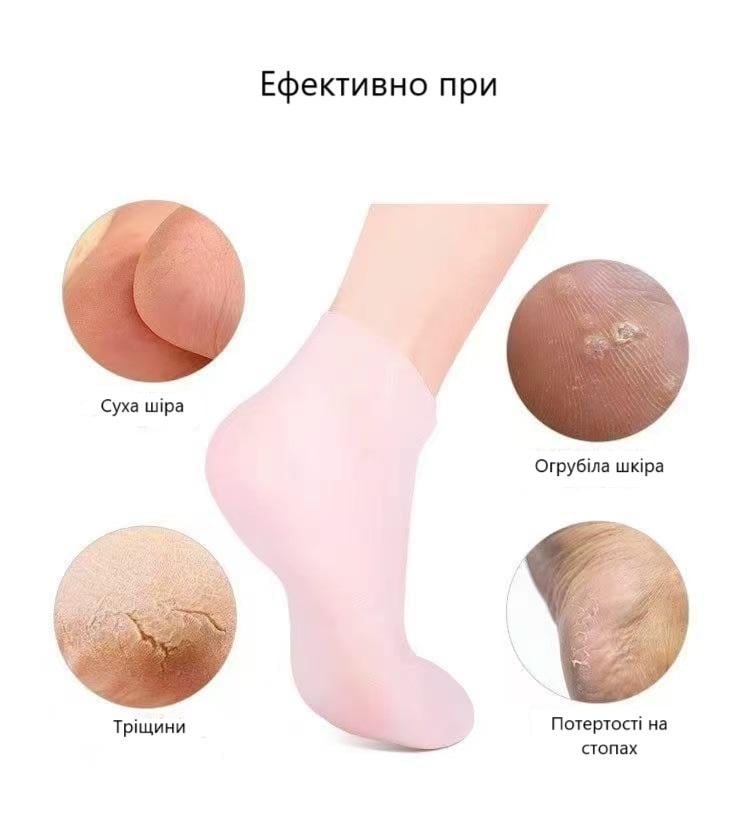 Носки для сухой и потрескавшейся кожи ног увлажняющие гелевые Розовый (29256 рож) - фото 7
