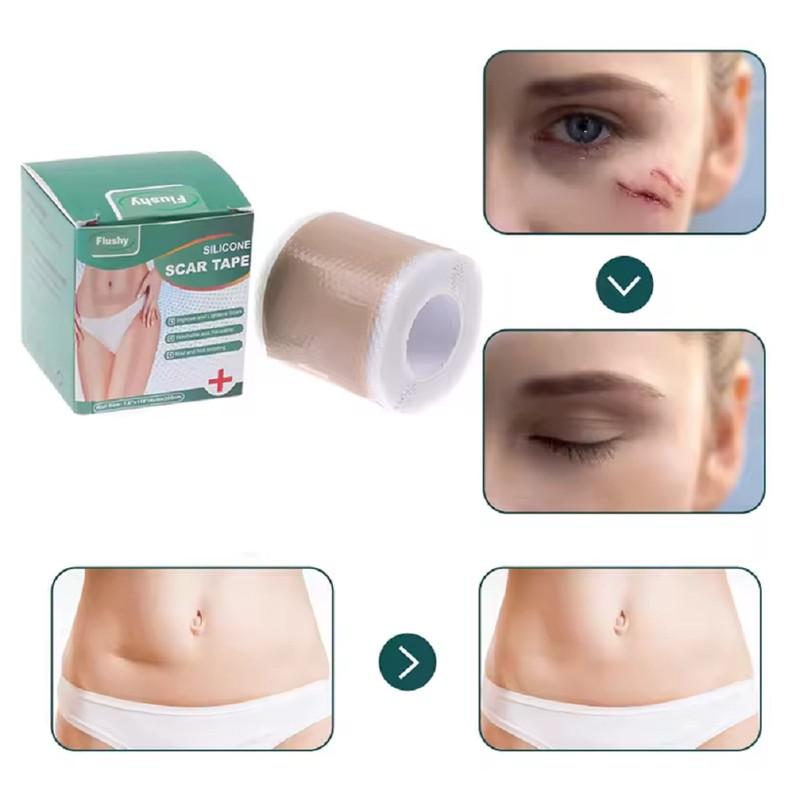 Пластырь для заживления рубцов после операции медицинский силиконовый при ожогах/растяжка/акне - фото 2