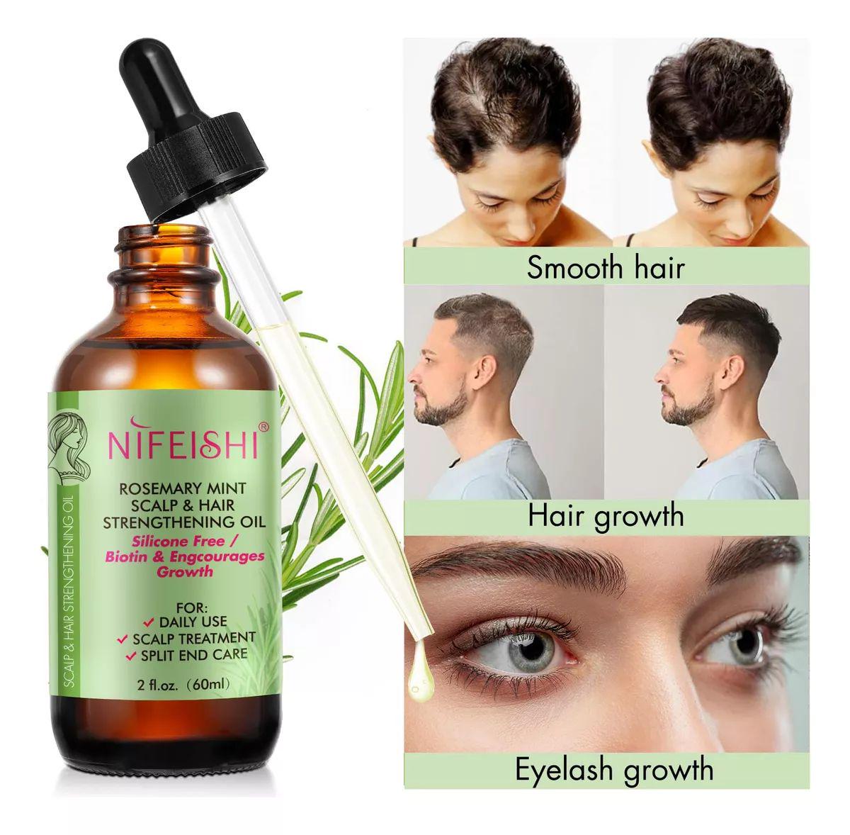 Масло Розмариновое NIFEISHI 100% Natural & Pure Rosemary Essential Oils для роста и питания волос 60 мл - фото 8 Масло Розмариновое NIFEISHI 100% Natural & Pure Rosemary Essential Oils для роста и питания волос 60 мл - фото 8