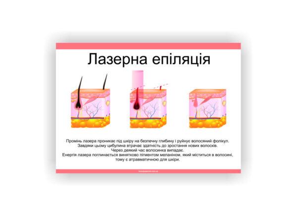 Плакат Vivay Лазерная эпиляция 60х80 см (23272043)