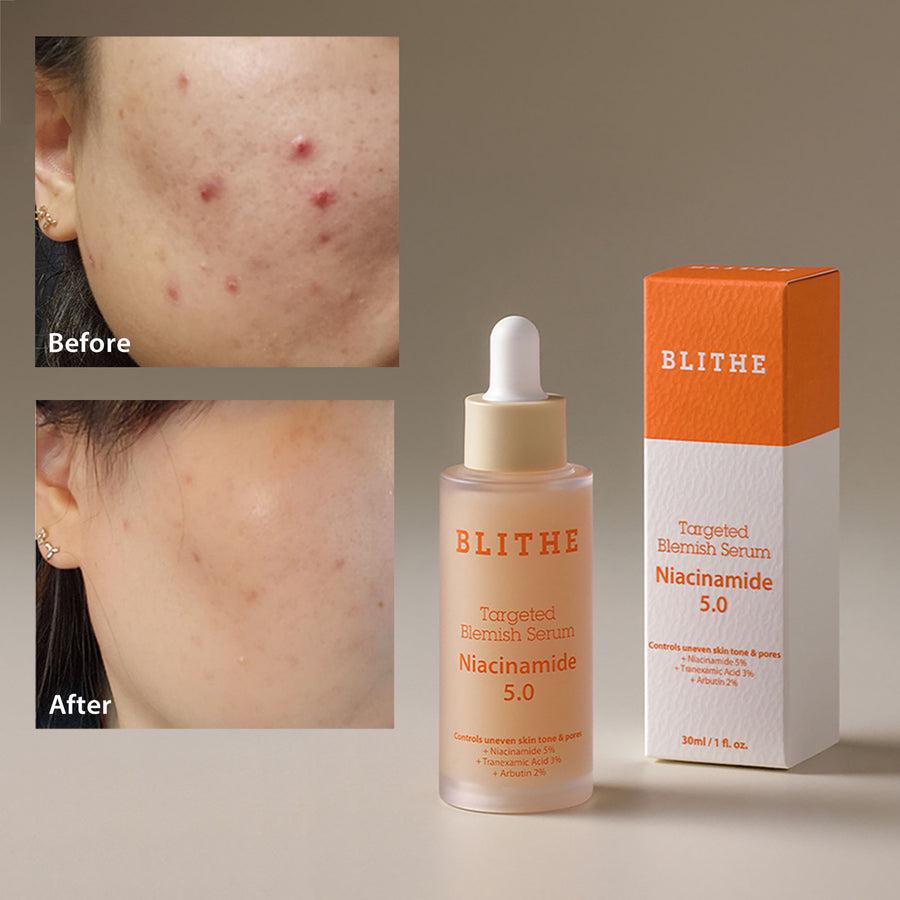 Сироватка Blithe Targeted Blemish Serum Niacinamide 5.0 освітлююча зміцнююча 30 мл - фото 2