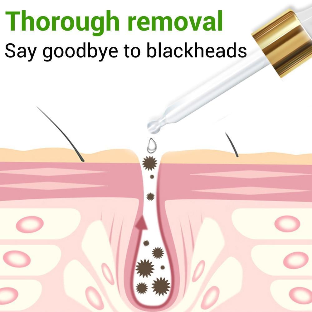 Сыворотка Lanbena с витамином C эффективно отбеливает удаляет веснушки - фото 4