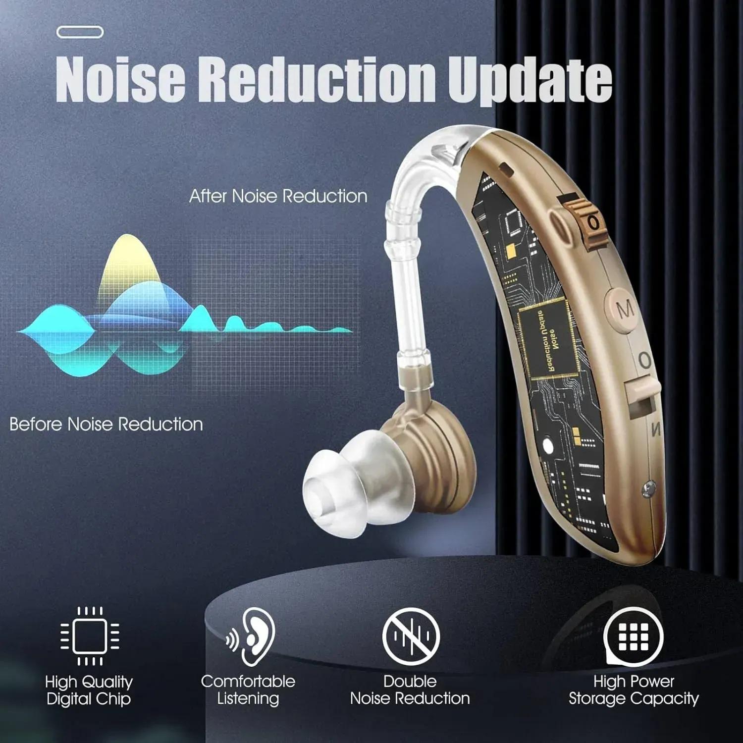 Слуховий апарат завушний цифровий акумуляторний до 80 годин роботи (4000706260900) - фото 8