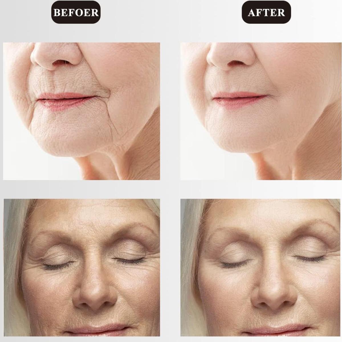 Масажер для обличчя та шиї Ms.W Neck Care - фото 6