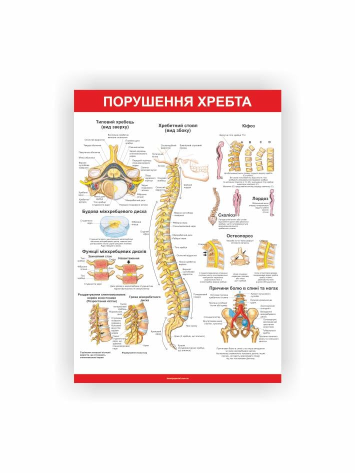 Плакат Vivay Порушення хребта 60х40 см (25698390)
