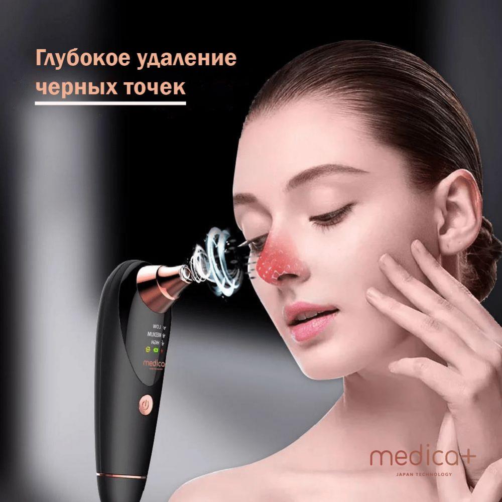 Вакуумний очищувач шкіри та пор MEDICA+ SKINCLEANER 9.0 BL гарантія 1 рік - фото 4