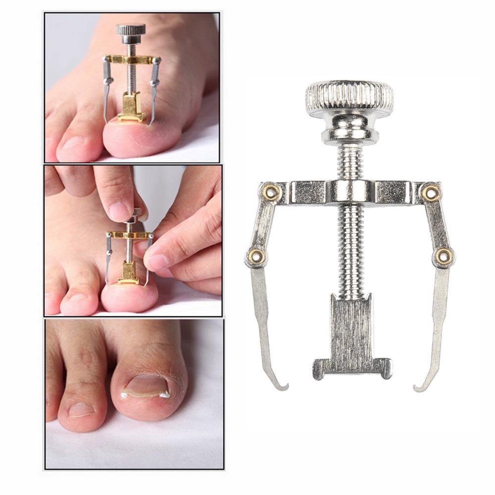 Коректор з металу для лікування врослого нігтя (R9480) - фото 9