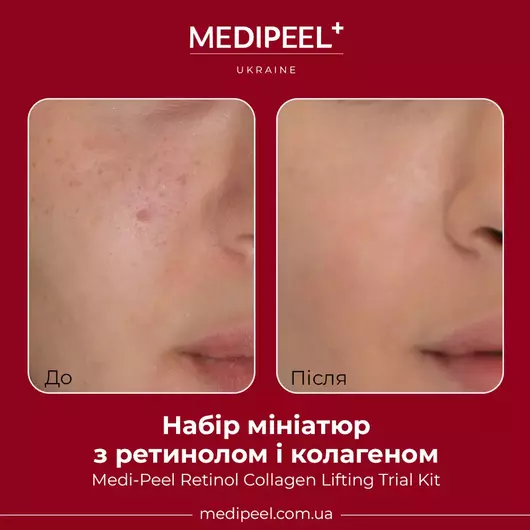 Набір мініатюр з ретинолом і колагеном Medi-Peel Retinol Collagen Lifting Trial Kit (Т000107) - фото 3