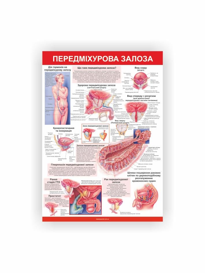 Плакат Vivay Предстательная железа 60x80 см (26944124)