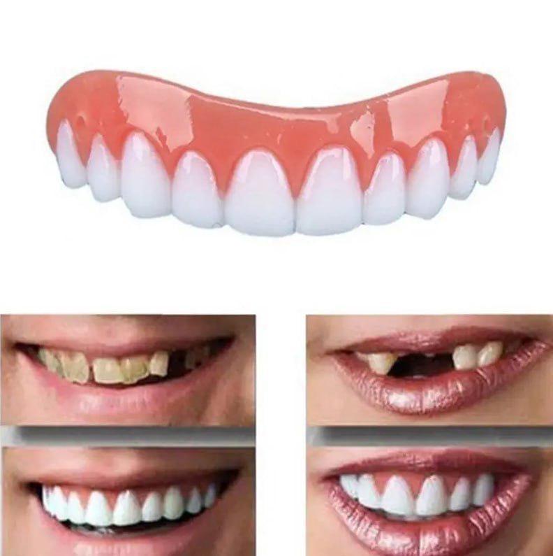 Виниры для зубов Perfect Smile Veneers съемные (29189) - фото 8