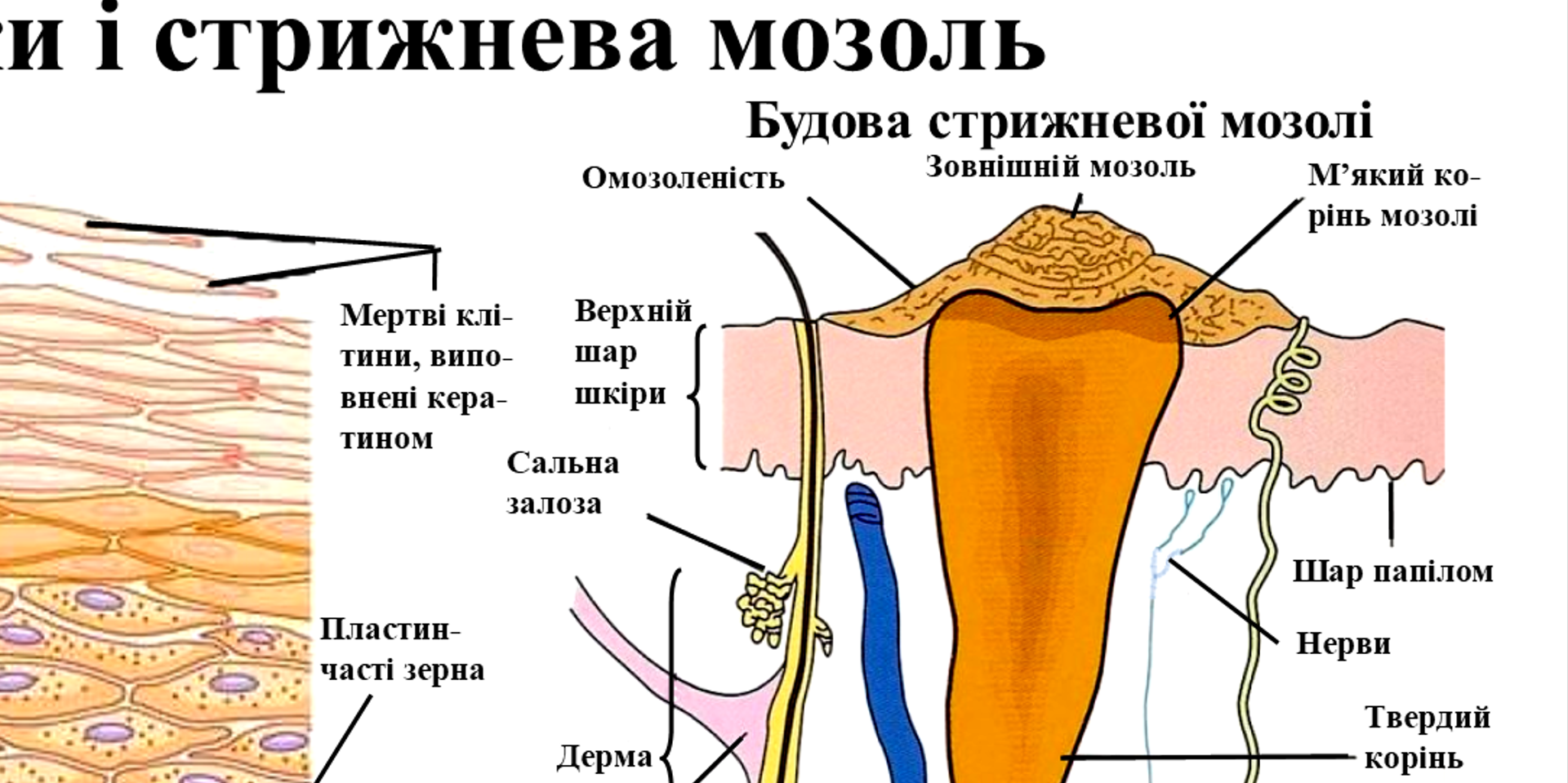 Анатомічний плакат Бородавки та стрижнева мозоль 420x594 мм (0027) - фото 2