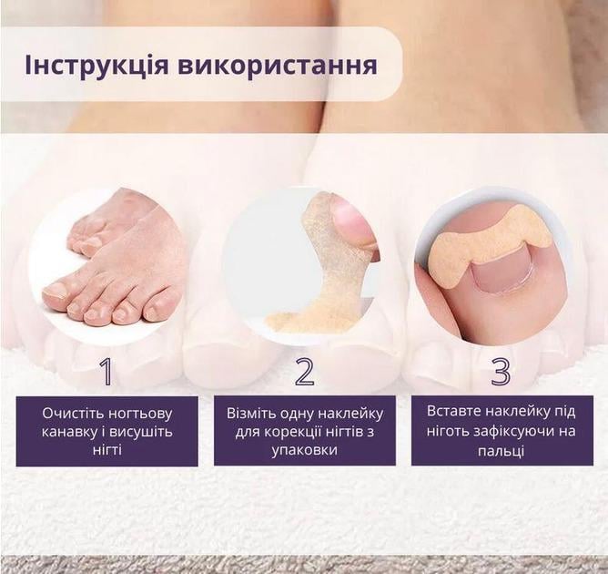 Набор пластырей Elastic Toenail Correction Sticker 50 pcs (ECS1000) - фото 6