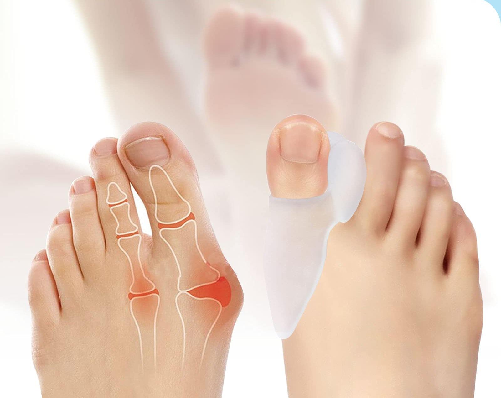 Протектор гелевый на косточку с перегородкой - фото 2 Протектор гелевый на косточку с перегородкой - фото 2