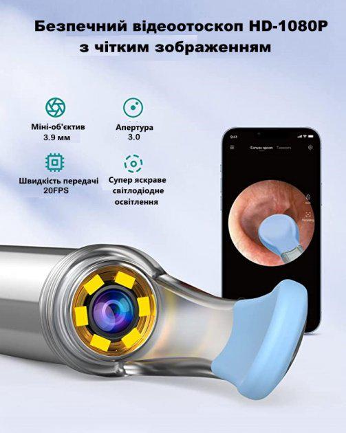 Инструмент для удаления ушной серы BEBIRD R1 с отоскопом 1080P с 2-мя силиконовыми ушными ложечками Черный - фото 3