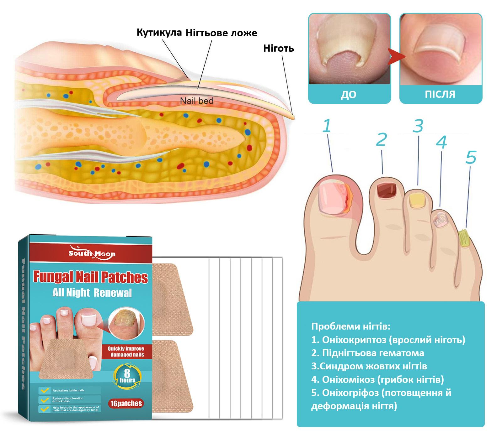 Коригувальні пластир-наклейки R9360 для врослих нігтів Nail Patches в упаковці 16 шт. - фото 4 Коригувальні пластир-наклейки R9360 для врослих нігтів Nail Patches в упаковці 16 шт. - фото 4