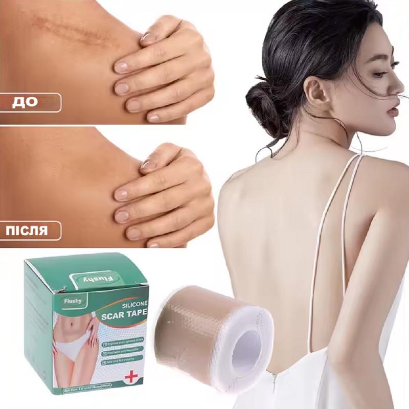 Пластырь для заживления рубцов после операции медицинский силиконовый при ожогах/растяжка/акне - фото 4