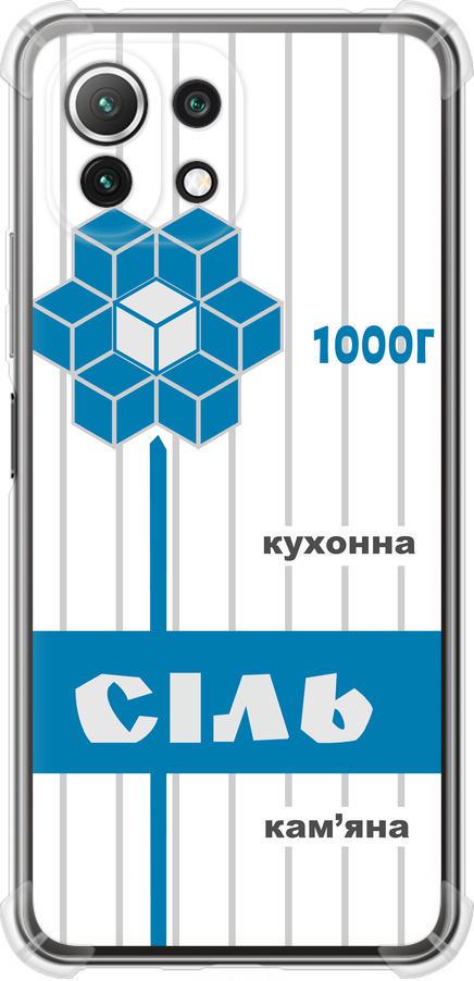 Чехол на Xiaomi Mi 11 Lite Соль UA (5625sp-2281-42517)