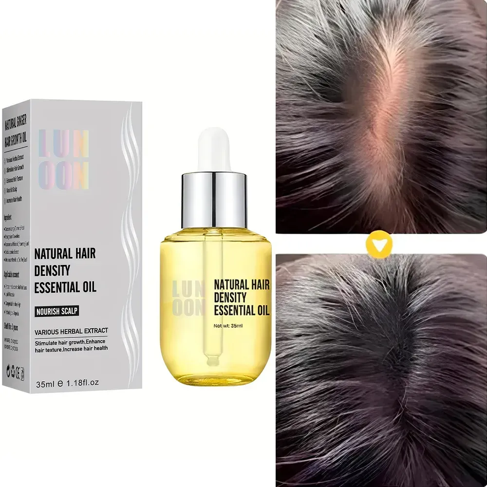 Масло для роста волос 35 мл LUNOON/Масло (30444392) - фото 2 Масло для роста волос 35 мл LUNOON/Масло (30444392) - фото 2