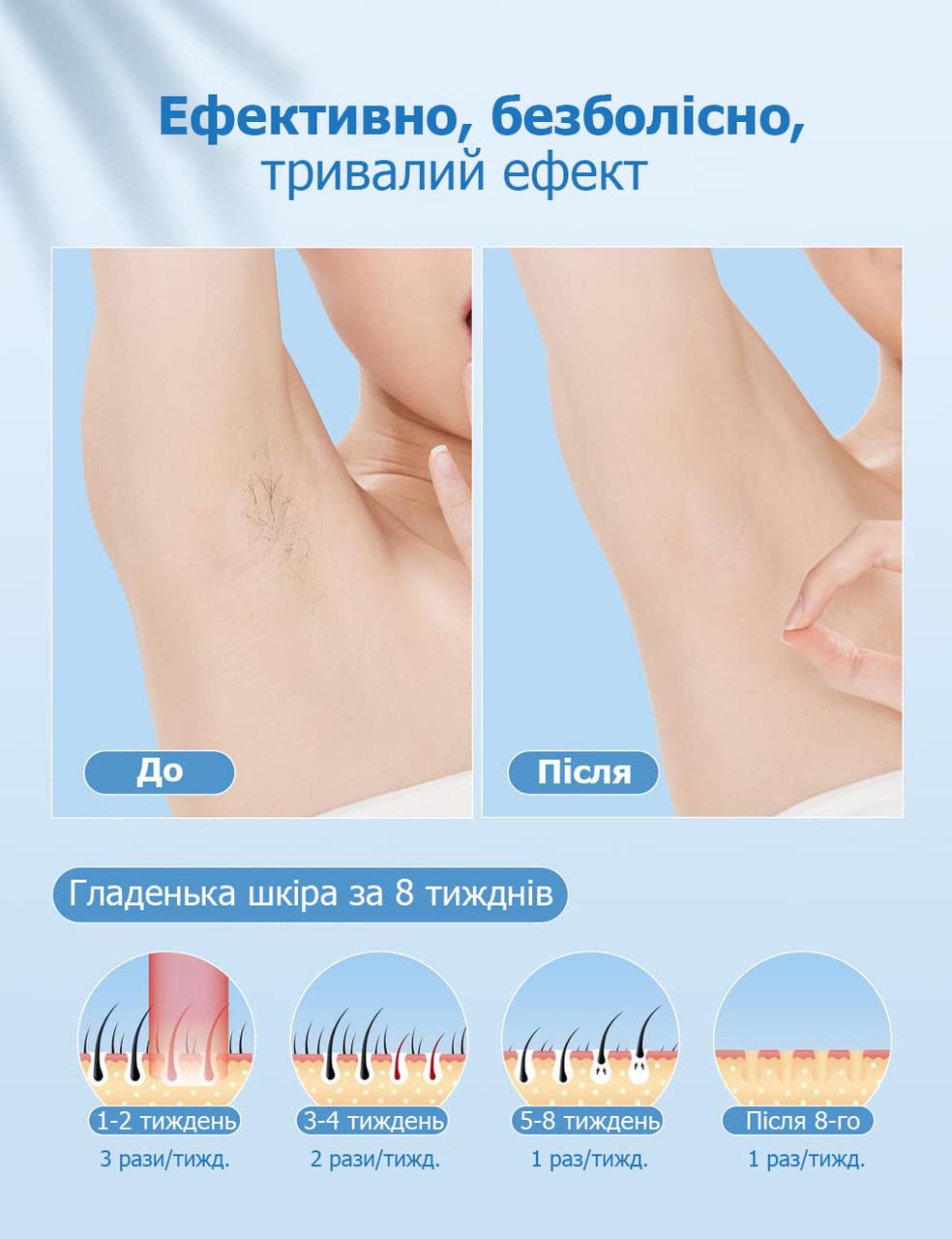 Фотоэпилятор IPL Ice Cool Hair Removal BH03 999900 вспышек для удаления волос - фото 4