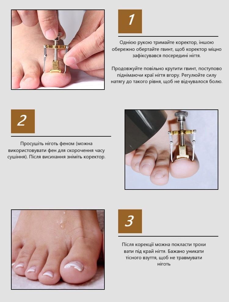 Коректор з металу для лікування врослого нігтя (R9480) - фото 5