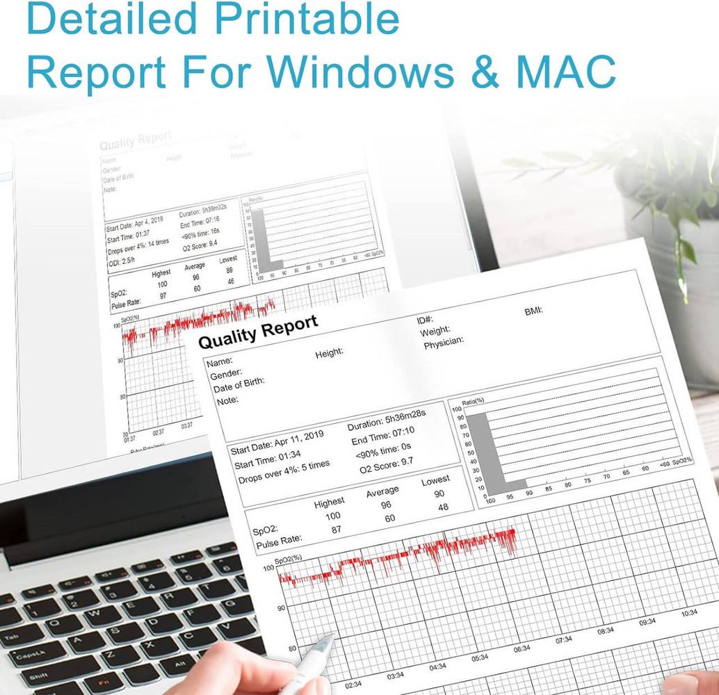 Пульсоксиметр Wellue O2 з інтелектуальним нагадуванням вимірювання SpO2 та пульсу медичний - фото 11 Пульсоксиметр Wellue O2 з інтелектуальним нагадуванням вимірювання SpO2 та пульсу медичний - фото 11