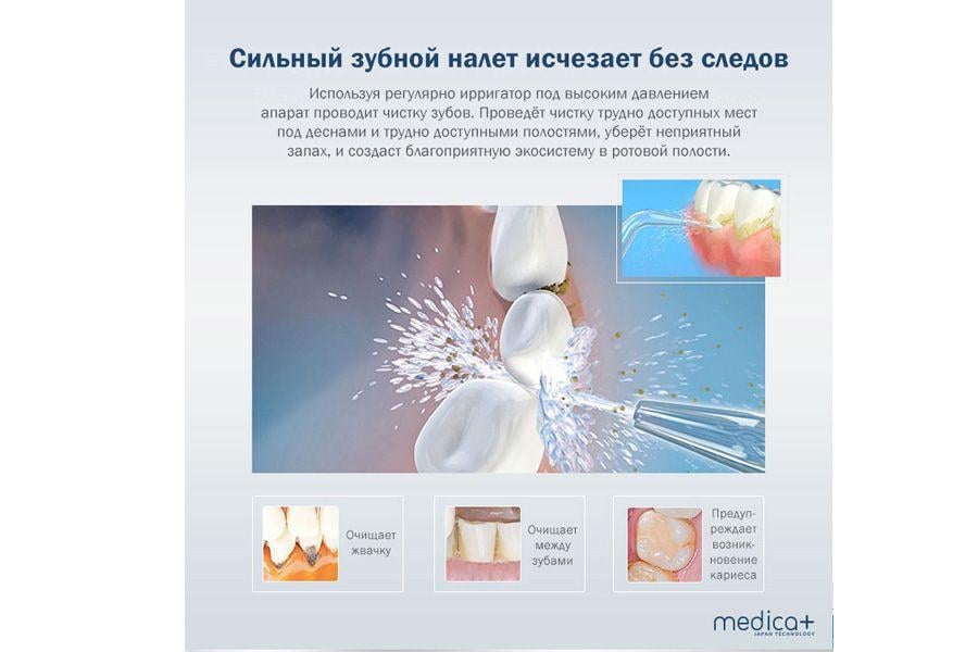 Стаціонарний ірригатор MEDICA+ ProWater Station 7.0 гарантія 1 рік - фото 8 Стаціонарний ірригатор MEDICA+ ProWater Station 7.0 гарантія 1 рік - фото 8
