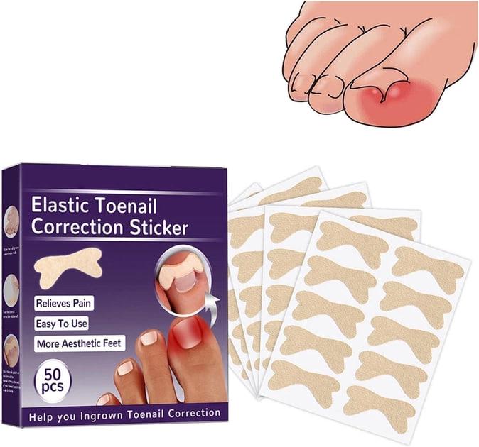 Пластыри Elastic Toenail Correction Sticker для коррекции и устранения вросших ногтей 50 шт. (429554558) - фото 2