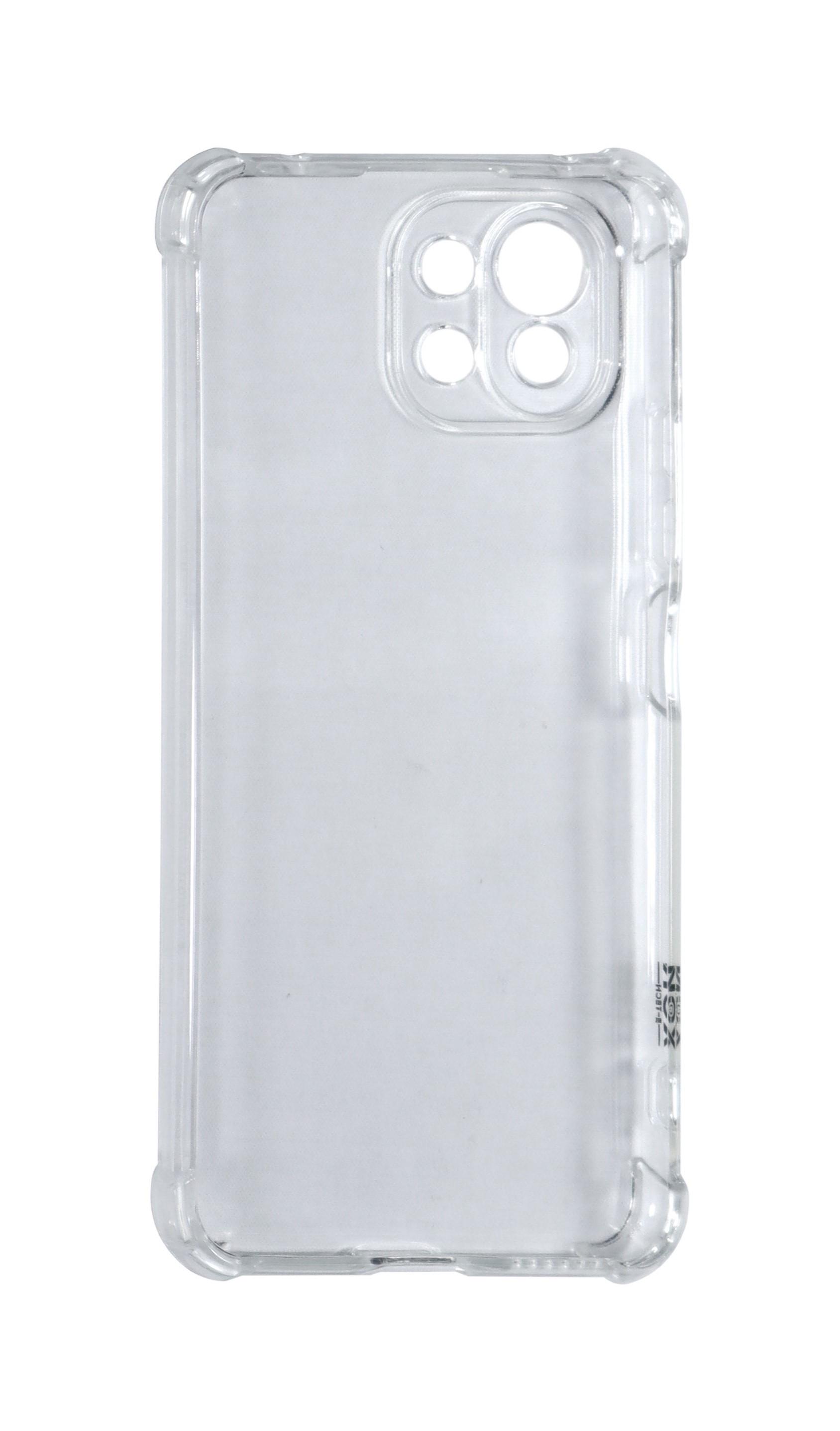 Чохол XON PhoneCase для Xiaomi Mi 11 Lite (PCSA3111101T 0502) Прозорий - фото 3 Чохол XON PhoneCase для Xiaomi Mi 11 Lite (PCSA3111101T 0502) Прозорий - фото 3