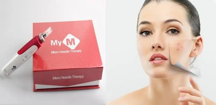 Аппарат мезотерапии фракционной My-M Dermapen (28798385) - фото 2 Аппарат мезотерапии фракционной My-M Dermapen (28798385) - фото 2