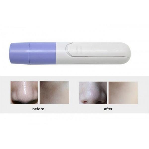 Аппарат для вакуумной чистки/пилинга кожи лица от черных точек Pore Cleaner - фото 5 Аппарат для вакуумной чистки/пилинга кожи лица от черных точек Pore Cleaner - фото 5